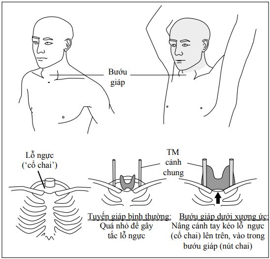 khám tuyến giáp ở khoa nào 