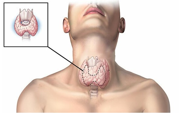 xạ hình tuyến giáp sau phẫu thuật 