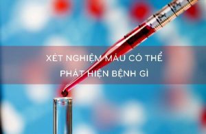 Xét nghiệm sinh hóa máu