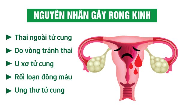 Hiện tượng rong kinh ở phụ nữ