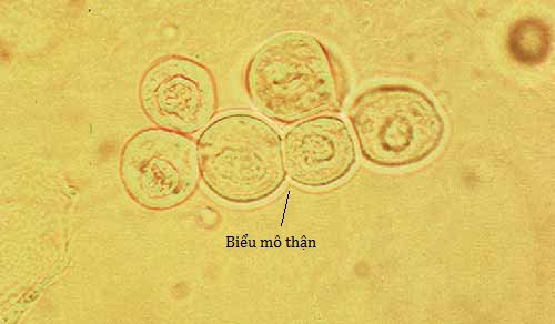 Phân loại tế bào biểu mô nước tiểu