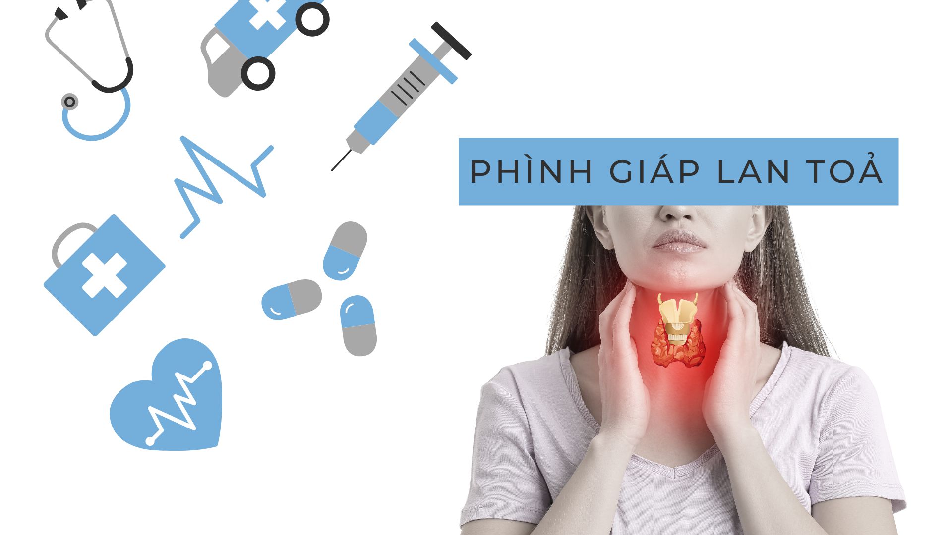 Phình giáp lan toả