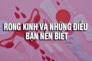 Rong kinh