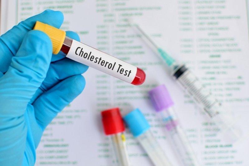 nguyên nhân tăng cholesterol trong máu