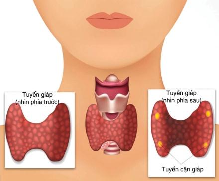 u tuyến giáp đến nam giới